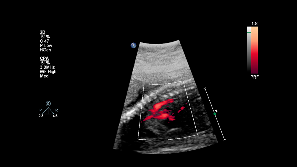 Echocardiography